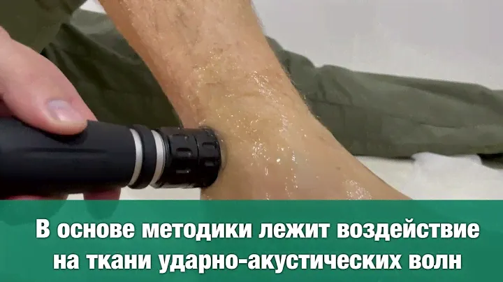 Ударно - волновая терапия